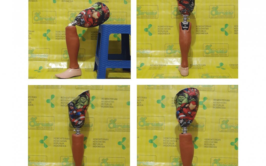 Kaki Prosthesis edisi Avengers