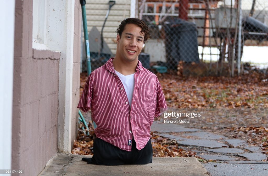 Gabe Adams Tak Punya Tangan dan Kaki Jago Break Dance