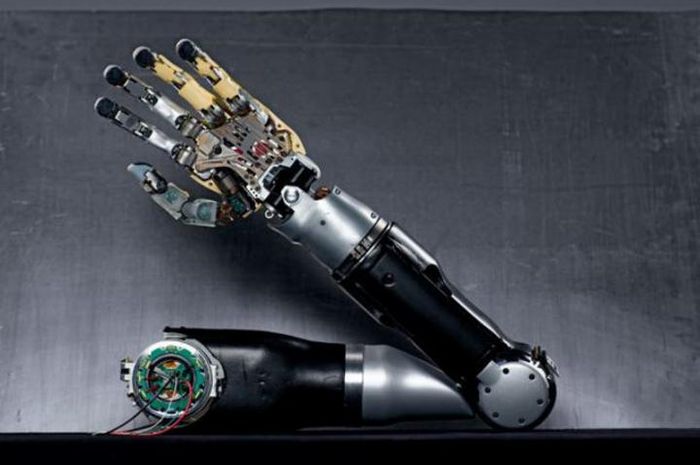 Seorang Manusia Bionik Amanda Kitts