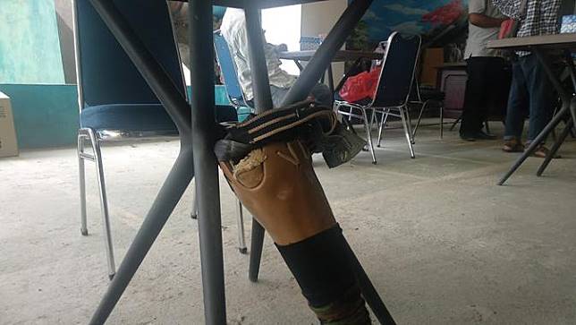 Fudin Menerima Bantuan Kaki Palsu Baru