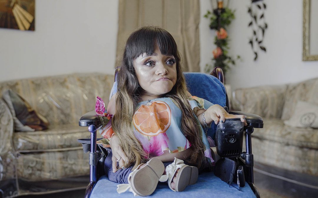 Memiliki Keterbatasan Tak Halangi Cary Menggapai Mimpi