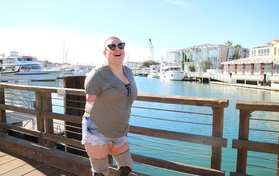 Kaitlyn Dobrow Tanpa Kedua Tangan Sukses Jadi YouTuber