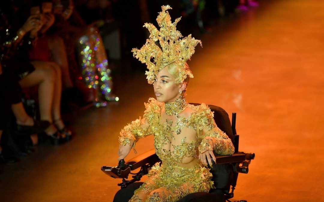 Jillian Mercado, Model Dengan Keterbatasan Yang Sukses