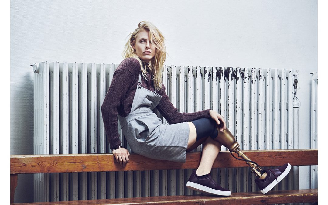 Lauren Wasser Model Mendunia Dengan Kaki Emasnya