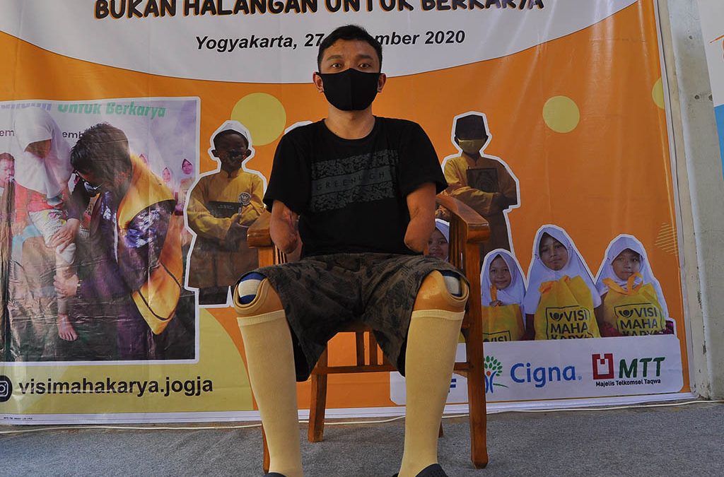 Dengan Bantuan Kaki Palsu Sigit Wahyudi Bisa Bangkit