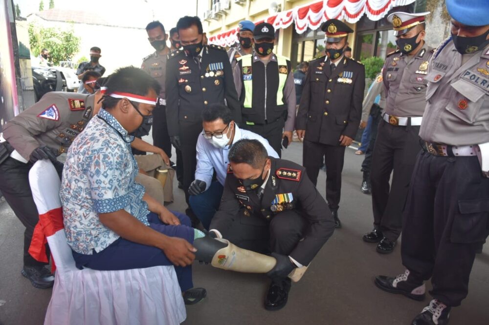 Toton Hartono Difabel Cirebon Bahagia Dapatkan Kaki Palsu