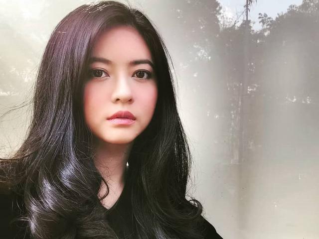 Qory Sandioriva Seorang Artis Dan Puteri Indonesia 2009 Yang Menderita Lupus