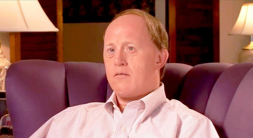 Pria Muda Penderita Down Syndrome Yang Berbakat Di Dunia Peran