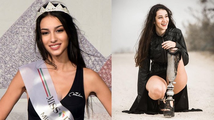 Wanita Disabilitas Berprestasi Di Ajang Miss Italy