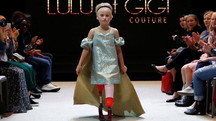 Gadis Cilik Menjadi Model Cantik Dengan Dua Kaki Palsunya