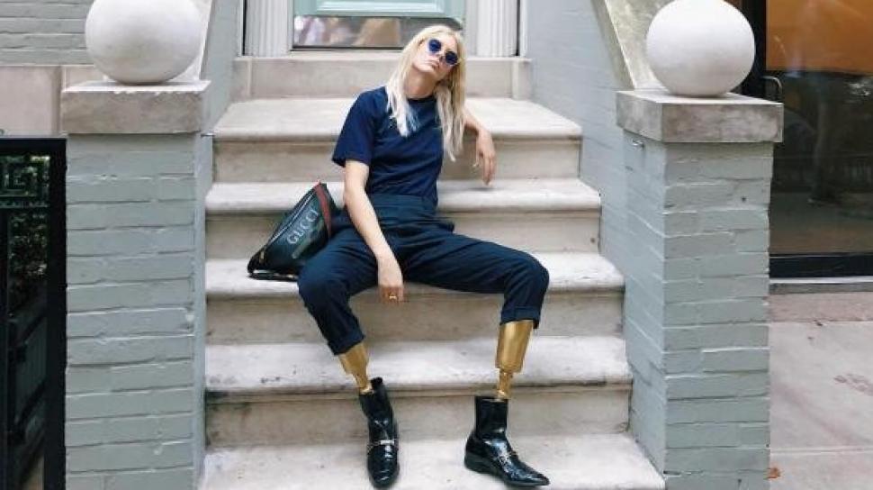 Model Berkaki Palsu yang Terkenal Di Kancah Dunia