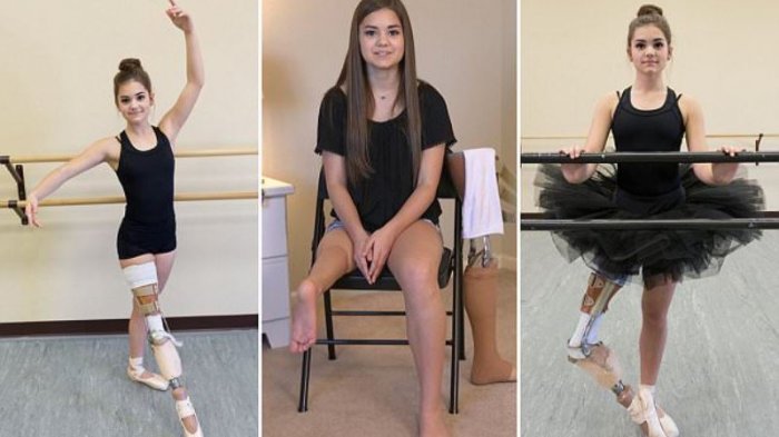 Gadis Cantik Penari Balet Dengan Satu Kaki