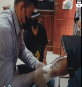 Pengukuran dan Pencetakan Kaki Prostesis Bawah Lutut