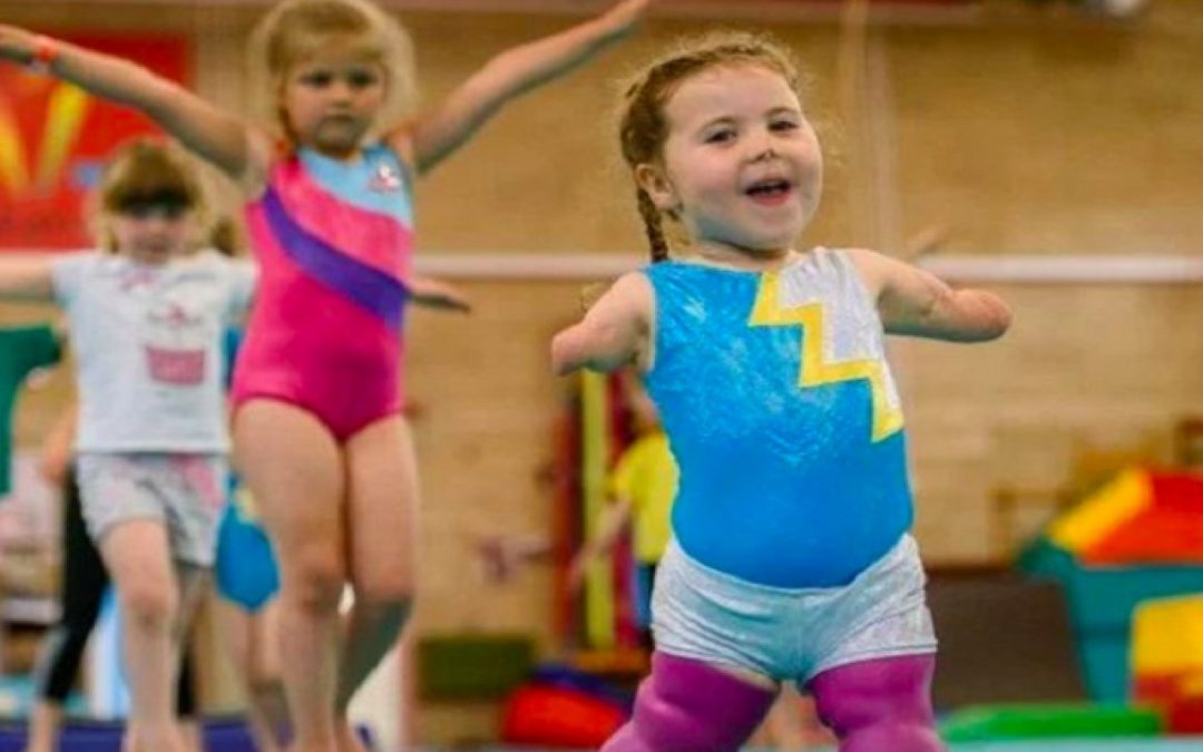 Kisah Harmonie Rose Allen yang berprestasi walau tidak punya tangan dan kaki