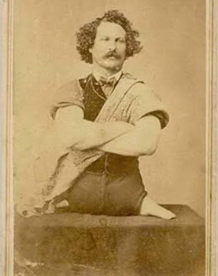 Orang Tak Berkaki yang Menjadi Pemain Akrobat