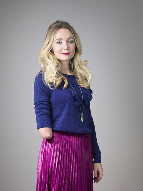 Cerrie Burnell Difabel Berprestasi