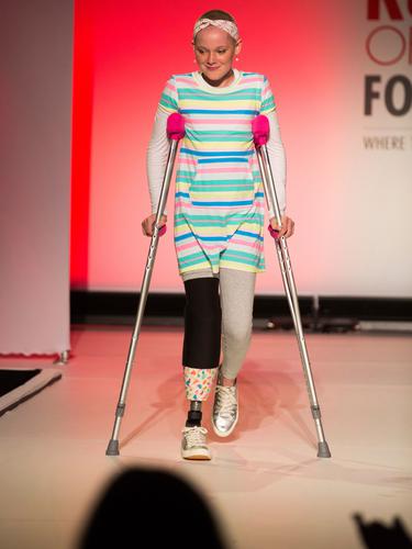 Amanda Lopes, Model Berkaki Satu