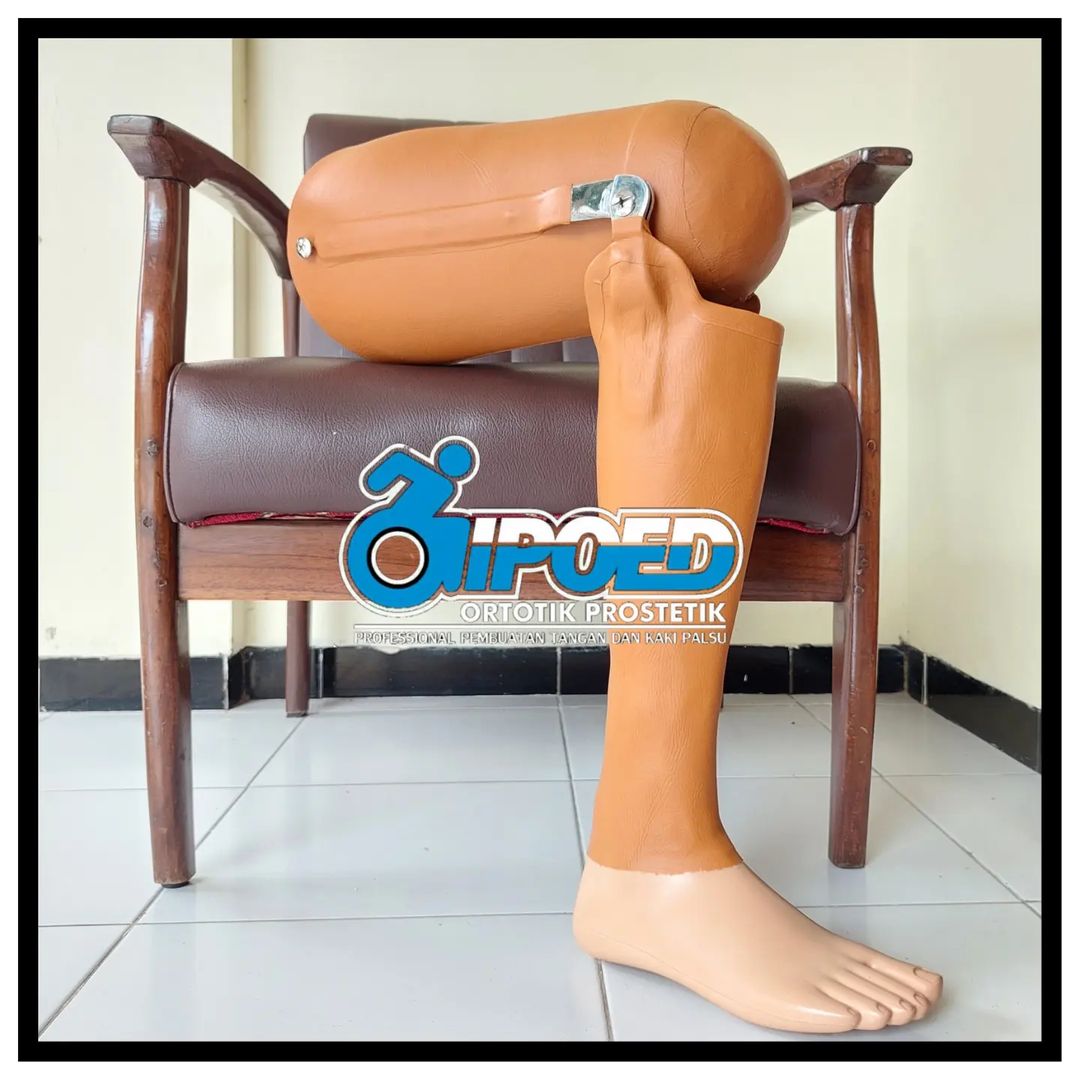 Prostesis Tepat Lutut Eksoskeletal