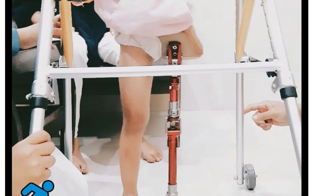 Tepat Hip Congenital anak