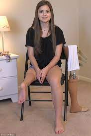 Penari Balet Berprestasi dengan Satu Kaki