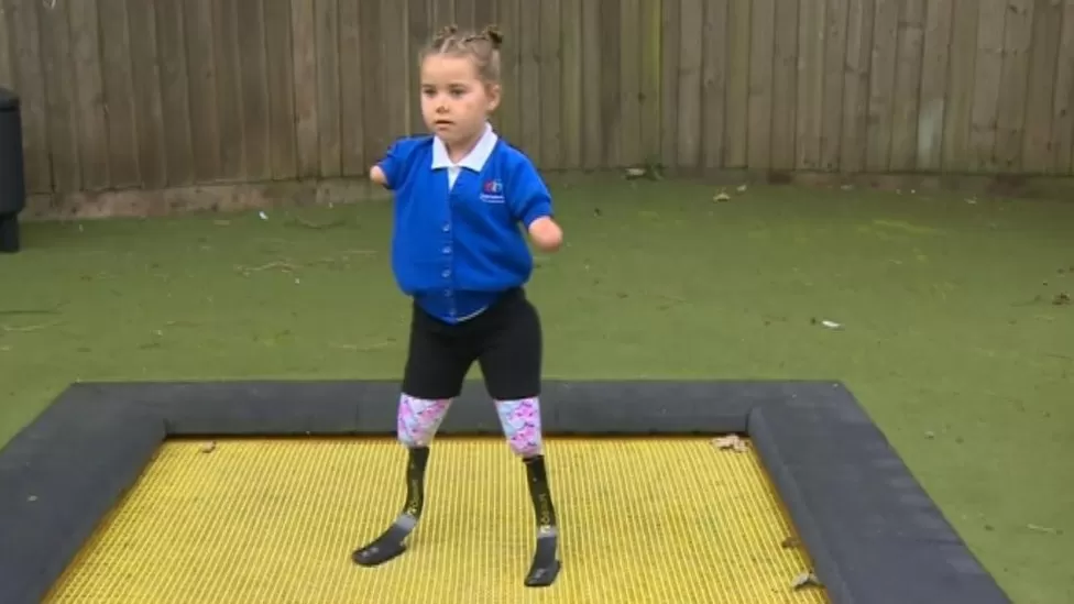 Harmonie Rose Allen, Anak Tanpa Kaki dan Tangan yang Berprestasi