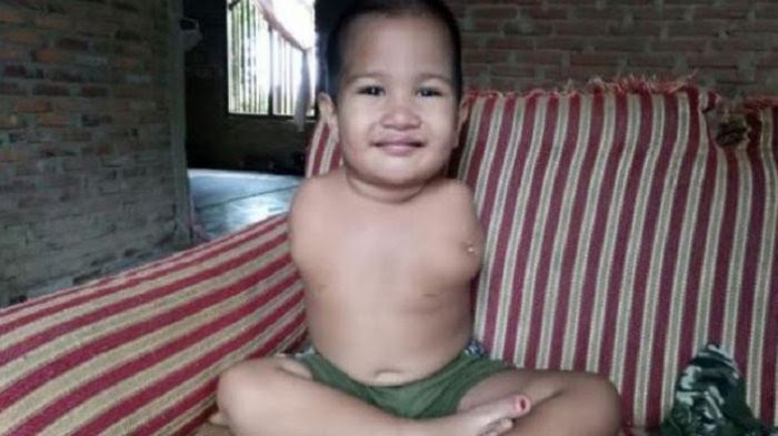 Kisah Bocah Haikal, Meski Tak Punya Tangan Tetap Bisa Menulis dan Makan Sendiri