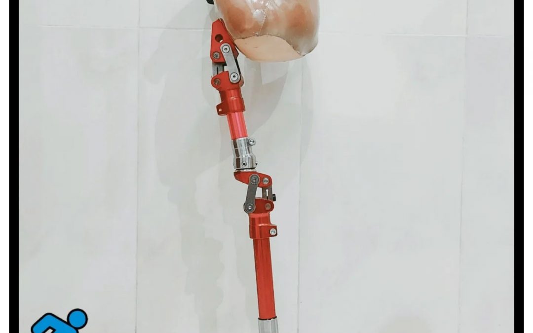 Hip Disarticulation Prosthesis