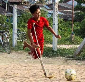 Pesepakbola ‘Satu Kaki’ Tiru Lionel Messi