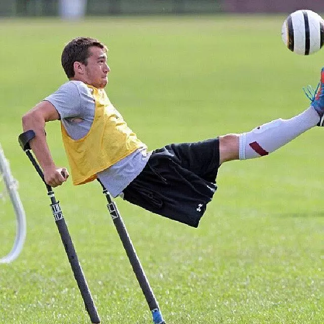 Nico Calabria, Pesepak Bola Dengan Satu Kaki