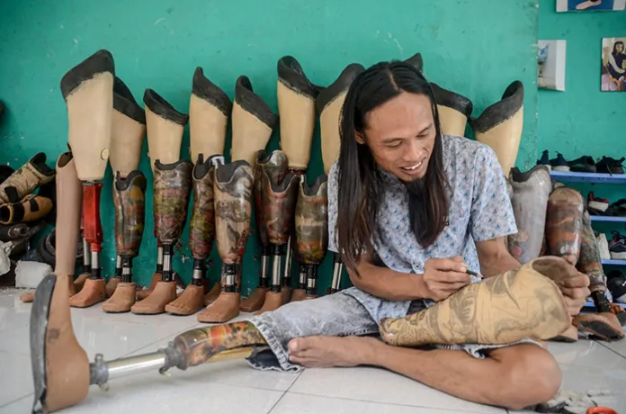 Kisah Ronald Regen Penyandang Difabel yang Berhasil Ciptakan Kaki Palsu