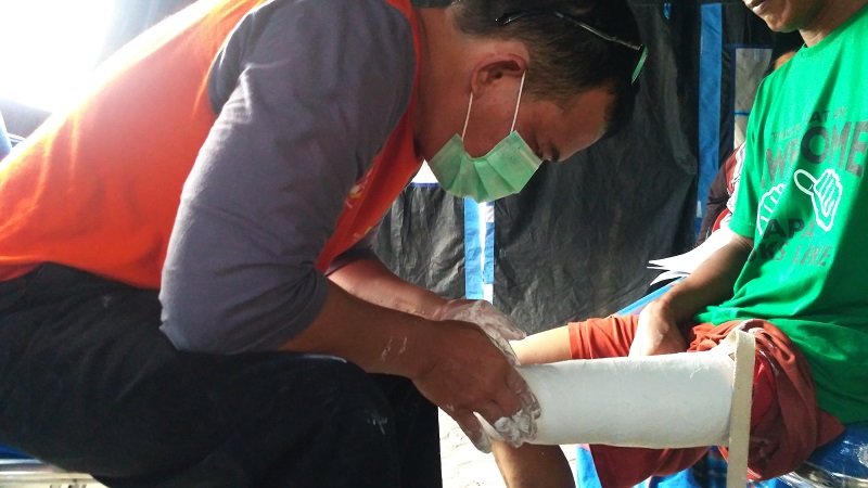 Meniti Asa di Atas Kaki Palsu