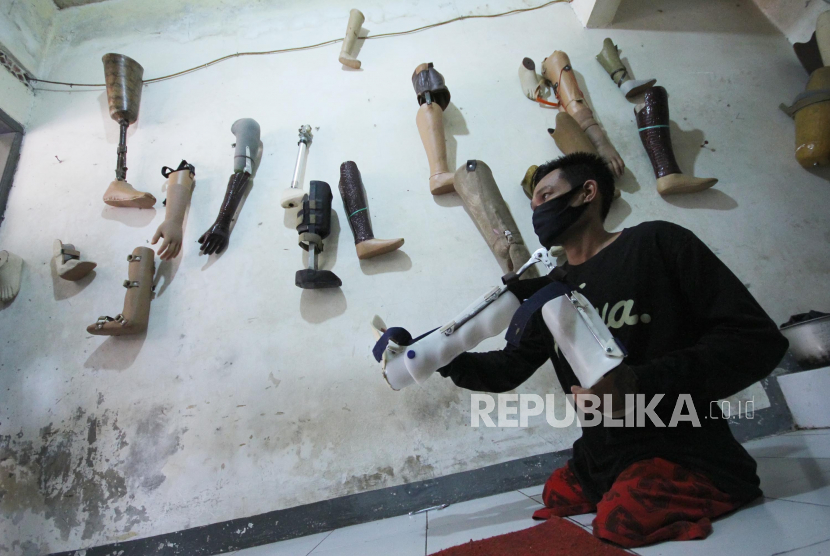 Senyum Apin Mendapat Dua Kaki Palsu