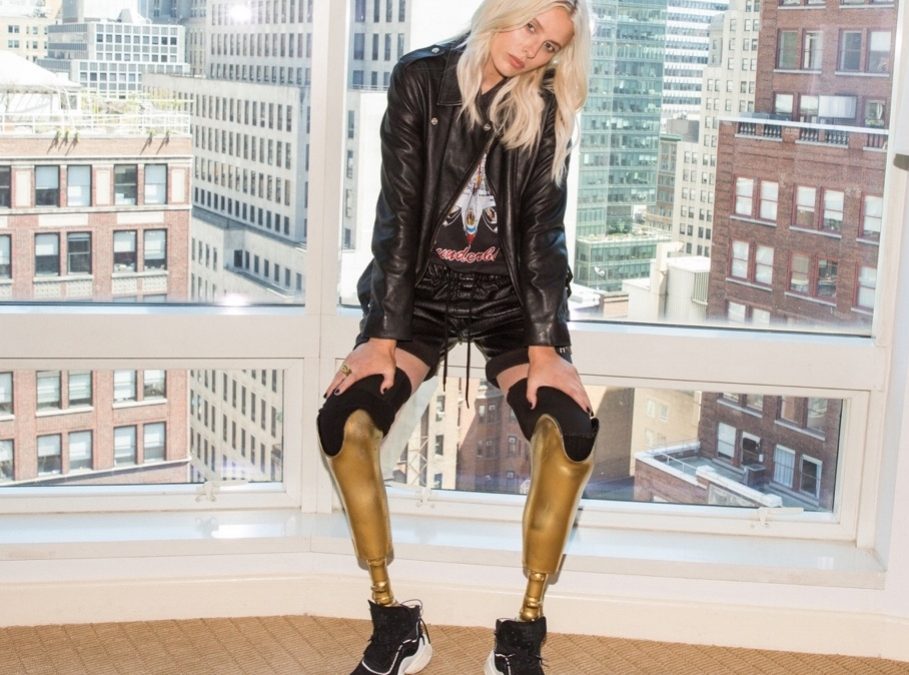 Lauren Wasser, Model Berkaki Palsu yang Mendunia