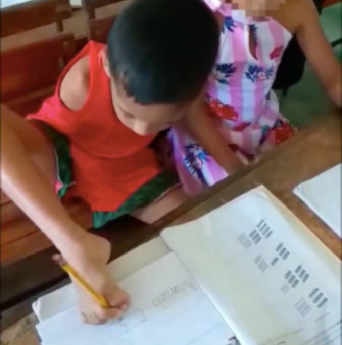 Marcielo, Bocah Lelaki  8 Tahun Tanpa Tangan