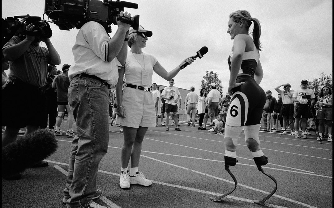 Aimee Mullins: Atlet Tanpa Kaki yang Sukses dalam Olahraga Lari dan Skating