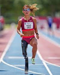 Scout Bassett: Pelari Paralimpiade Atas Kaki Di Atas Yang Mengatasi Adversitas Untuk Menjadi Juara