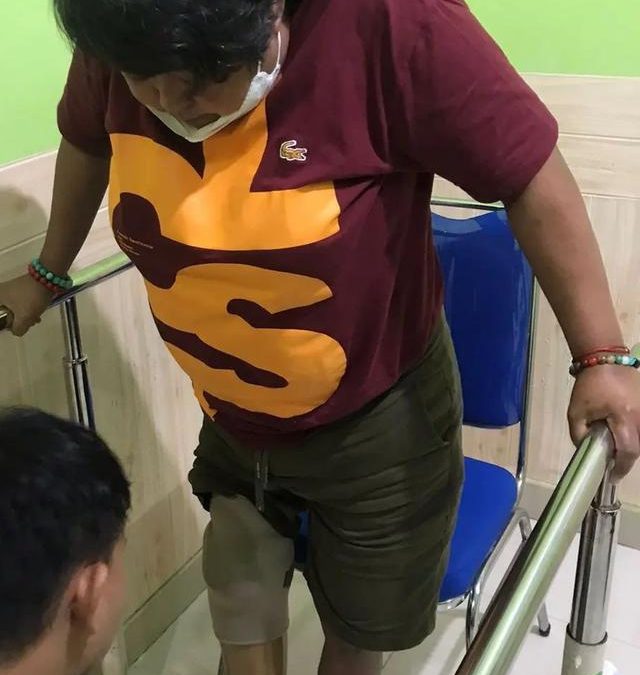 Suti Karno Diamputasi karena Penyakit Diabetes, Kini Bisa Berdiri menggunakan Kaki Palsu