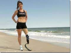 Amy adalah orang yang diamputasi di bawah lutut