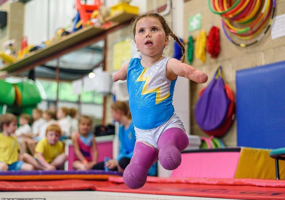 Harmonie Rose Allen Tetap Beprestasi Walau Tidak Punya Tangan dan Kaki