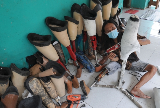 Ronald Regen si Pembuat Kaki Palsu untuk Para Difabel