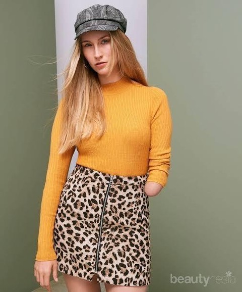 Model disabilitas Kelly Knox yang terlahir tanpa lengan kiri