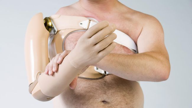 Evolusi Tangan Palsu,Tangan Palsu Pertama (218-201 SM)