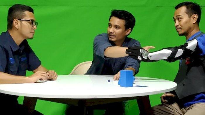 Cerita Yayat Gunakan Lengan Palsu Temuan Karla Bionics, Bentuknya Dibuat Berbeda, Lebih Robotik
