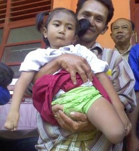 Tak Punya Kaki dan Jemari Tangan Tak Utuh, Dewi Berusaha Mandiri