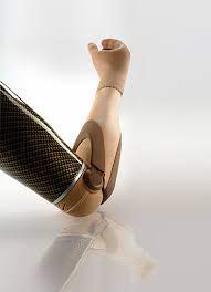 Jenis Perangkat Prostetis Transhumeral Disabilitas