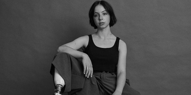 Iona Nay, Model dengan Kaki Palsu