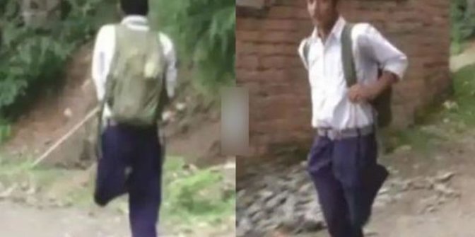 Perjuangan Siswa Difabel Berangkat Sekolah dengan Satu Kaki