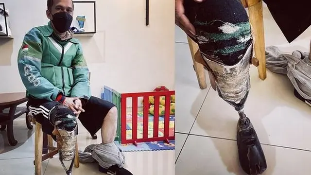 Kisah Ojol Berkaki Palsu dari Knalpot, Gigih Bekerja Demi Anak yang Berjuang Lawan Kanker