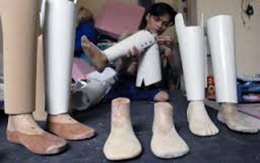 30 Penyandang Cacat di Sulsel Terima Kaki Palsu