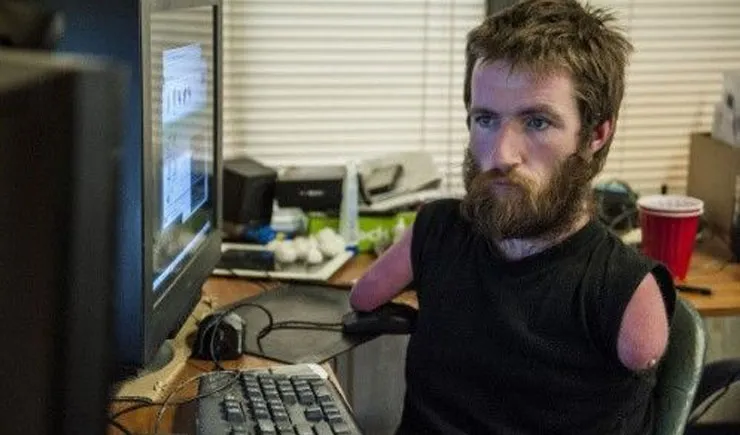 Kisah Michael Handi Olson, Gamers yang Berprestasi Meski Kehilangan Kaki dan Tangan